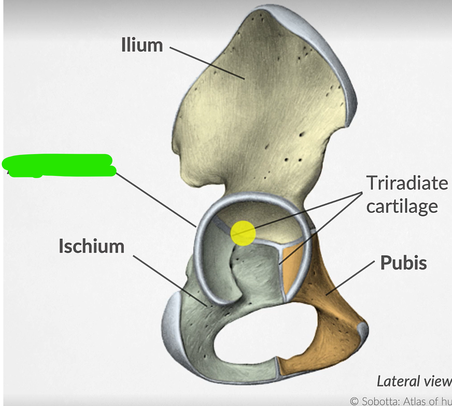 term image