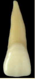 <p><mark data-color="blue" style="background-color: blue; color: inherit">maxillary central incisors #8 and #9; distal edge</mark></p>