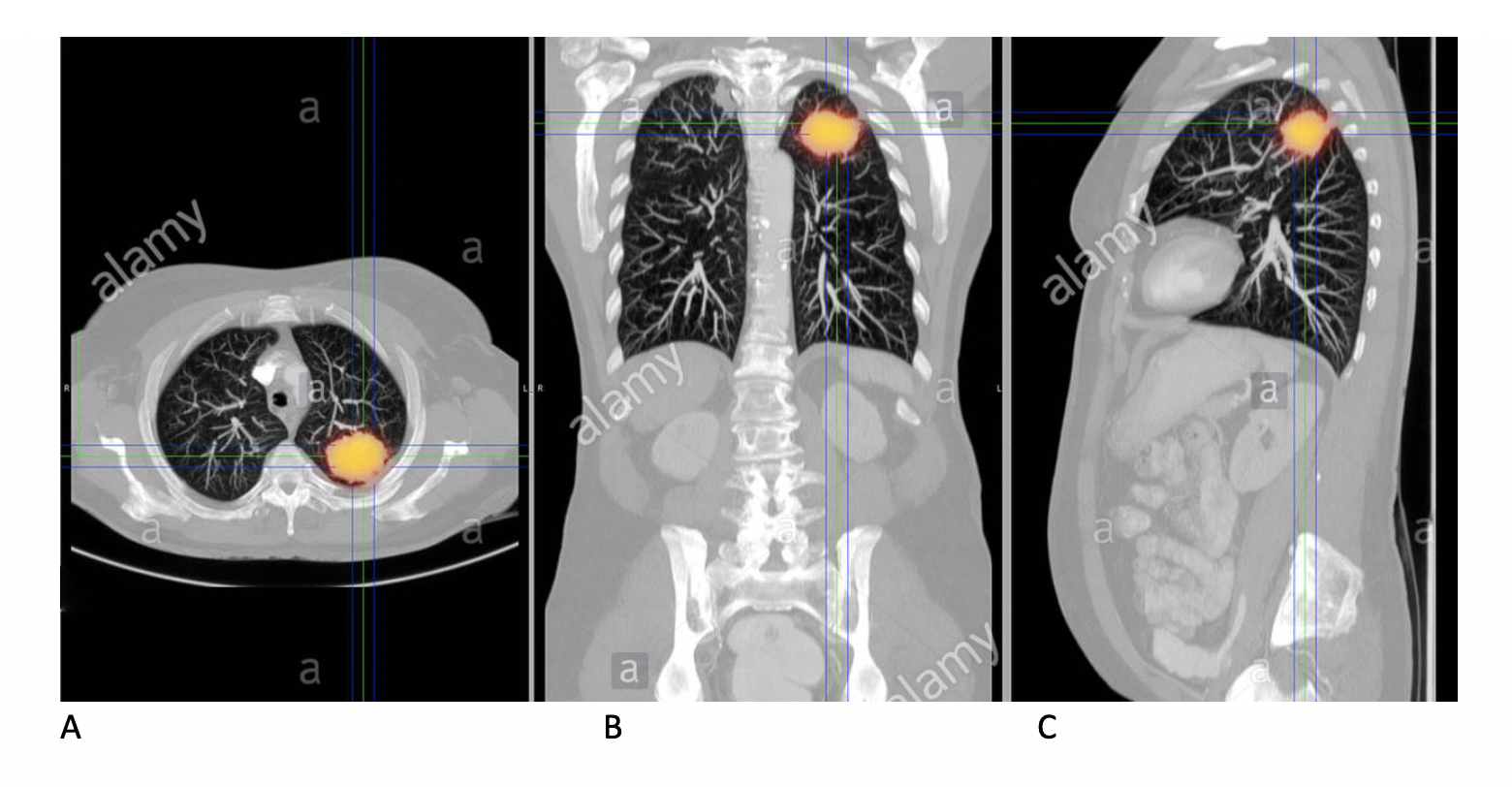 (Q1) The respiratory system are shown in what planes in images A to C?