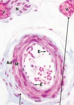 term image