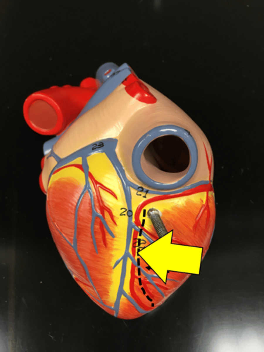 <p>Name the red vessel.</p>
