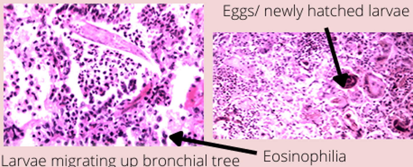 <p>- Small bronchi</p><p>- l1 in species</p><p>- Bronchioalveolar lavarge ( will have l1 present heare)</p>