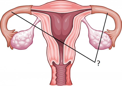 -Located in the abdominal cavity
-Part of the Female Reproduction Tract