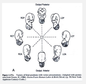 <p><strong>Vertex Presentation</strong></p><p>-Fetal position → relationship of the fetal _______ to maternal ______</p><p>-L/R OA → left/right occiput _______ (what you want)</p><p>-L/R OT → left/right occiput _________</p><p>-L/R OP → left/right occiput _________</p><p></p>