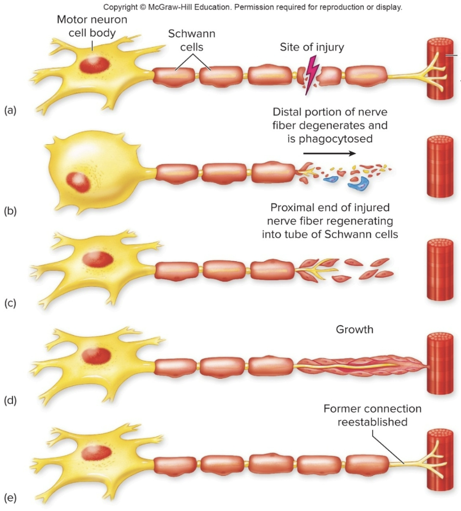 <ul><li><p>when an axon in the PNS is cut, the severed part degenerates, and a <strong>regeneration tube is formed by Schwann cells</strong></p></li><li><p><strong>growth factors</strong> (neurotrophic factors) are leased that <strong>stimulate growth of axon sprouts within the tube</strong></p></li><li><p>new axon eventually connects to the undamaged axon or effector</p></li></ul><p></p>