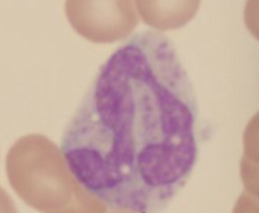 What type of leukocyte is this?