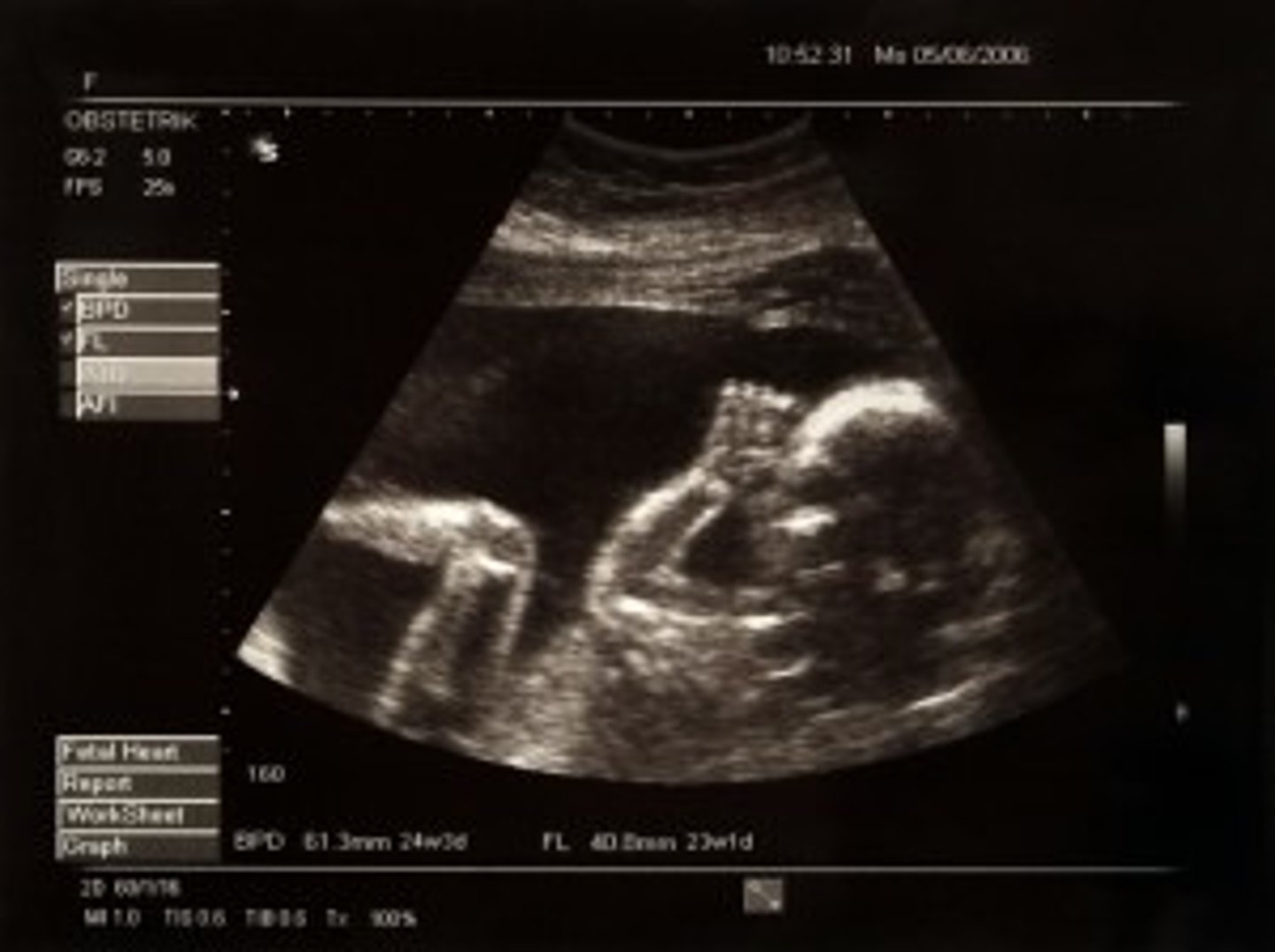 <p>ultrasound</p>