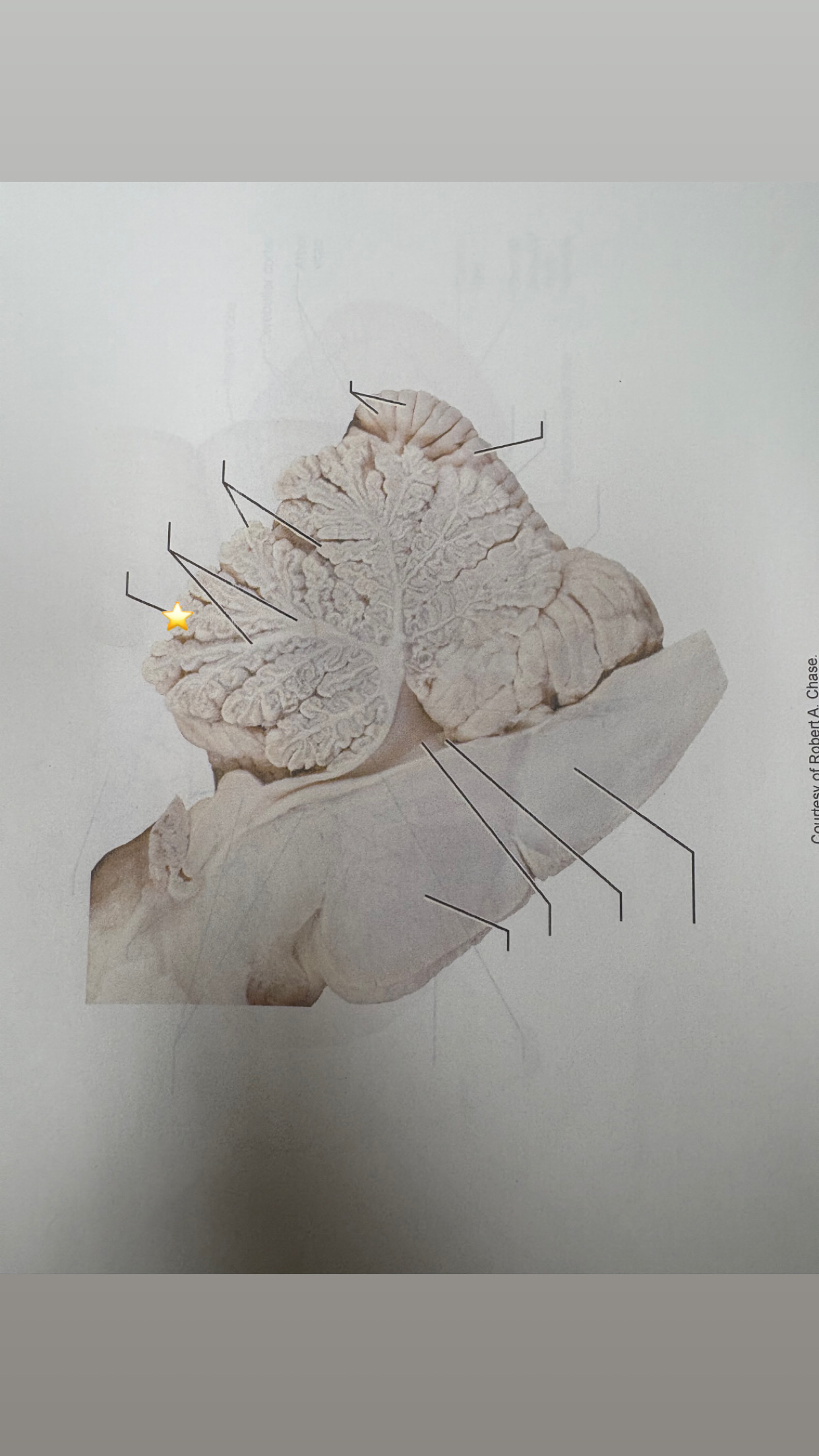 <p>name the starred structure</p>