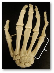 Name these bones of the hand.