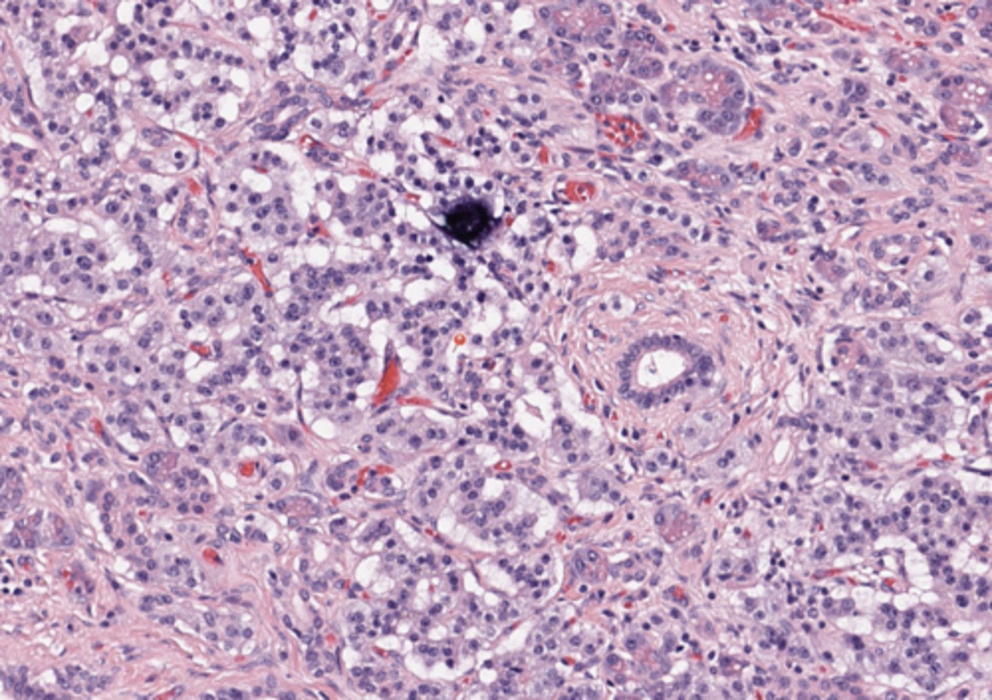 <p>Pancreas</p>