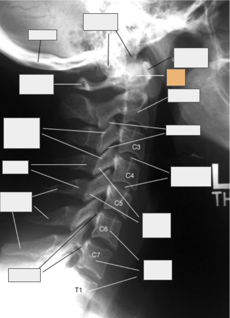 <p>What structure of the spine does the box highlighted in orange reference to?</p>