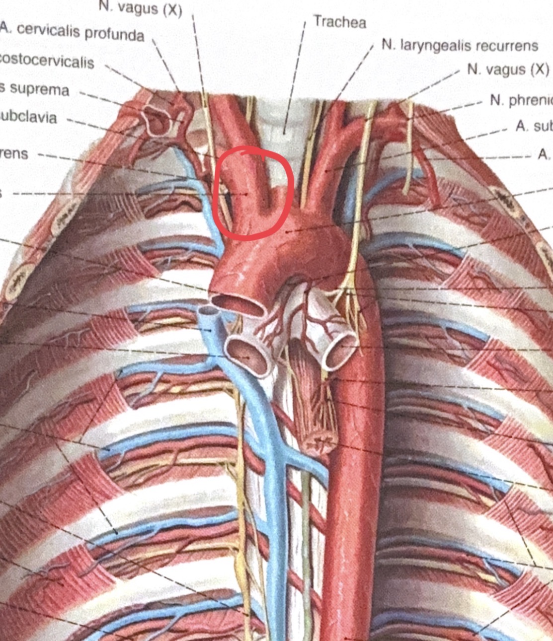 <p>truncus brachicephalicus</p>