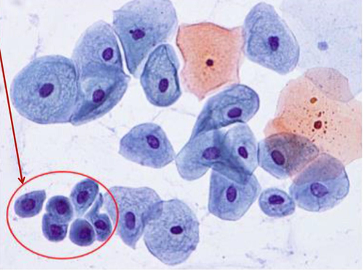 <p>Parabasal epithelial cells</p>