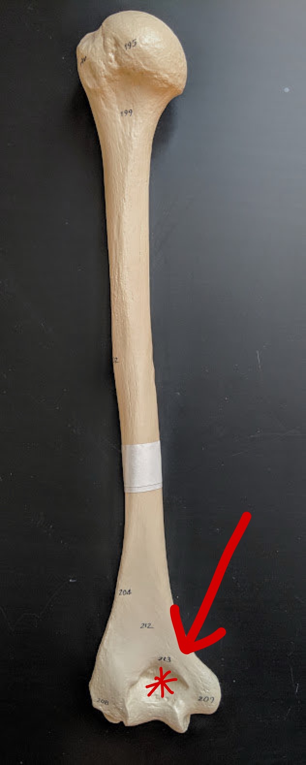 <p>Name this structure</p>