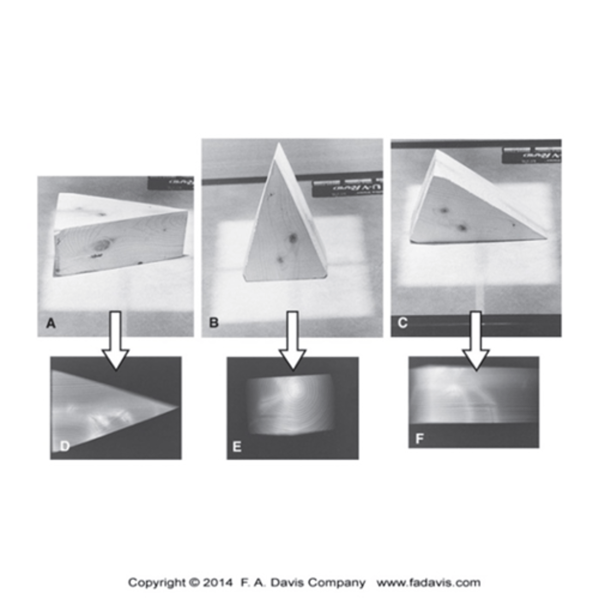<p>Tissue Radiodensity</p><p>- More dense = More radiopaque (white/light)</p><p>- Less dense = More radiolucent (</p>