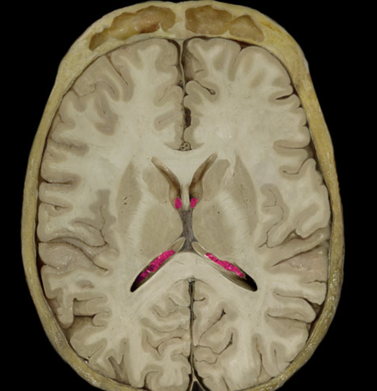 term image