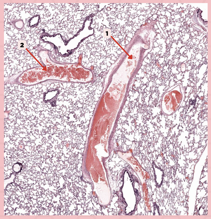 <p>Identify the structure labeled as 2.</p>