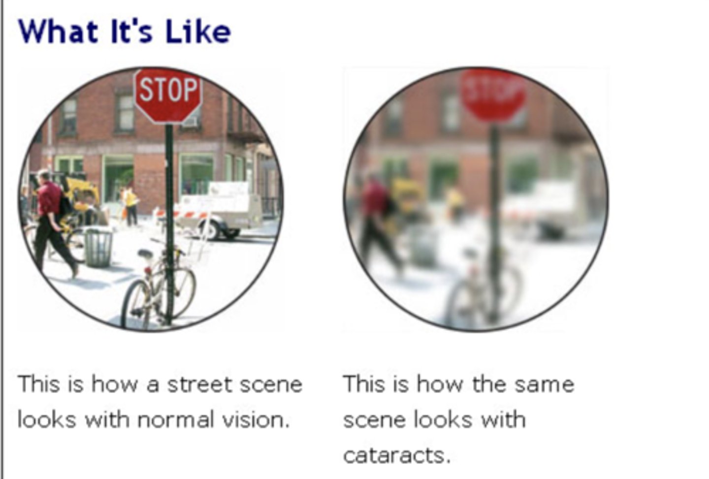 <p>cloudy lens </p><p>Colors that may not appear as bright as they once did.</p><p>glare</p><p>poor night vision</p>