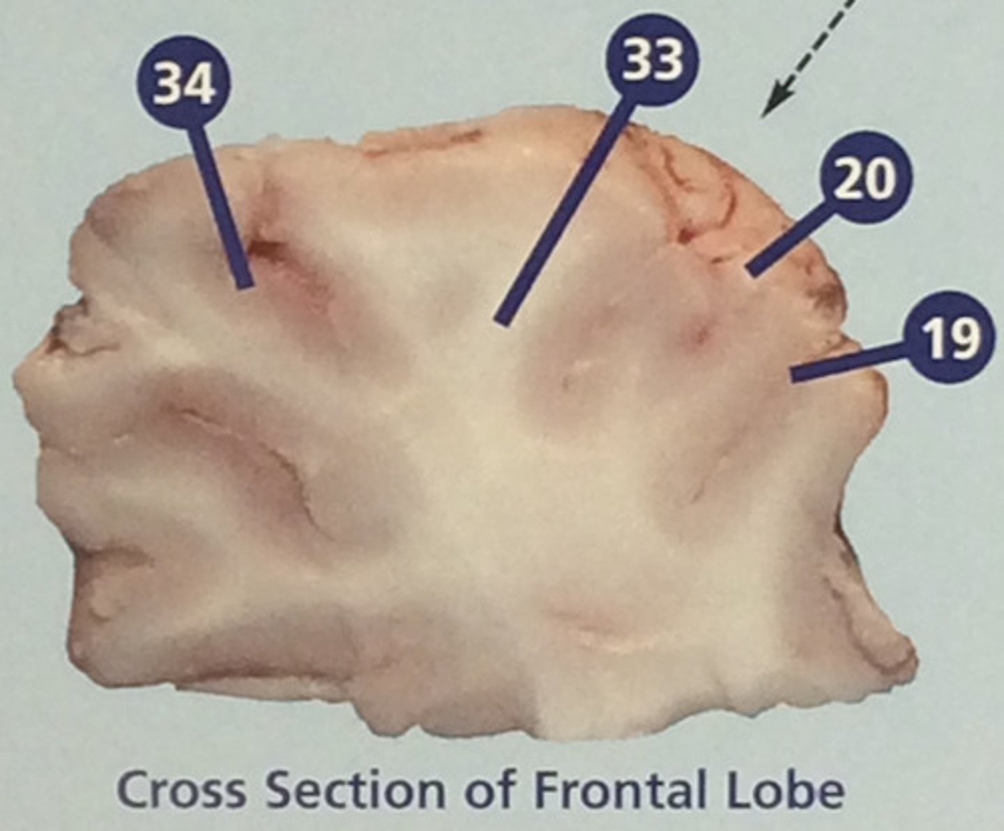 <p>Portions of the central nervous system made up mainly of myelinated nerve fibers; in the cerebrum, usually surrounded by gray matter (#33)</p>