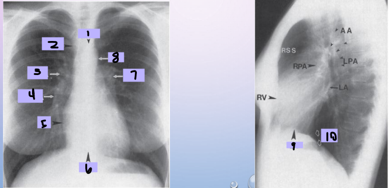 <p>#6</p>