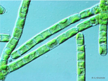 <p>What is this algae?</p>
