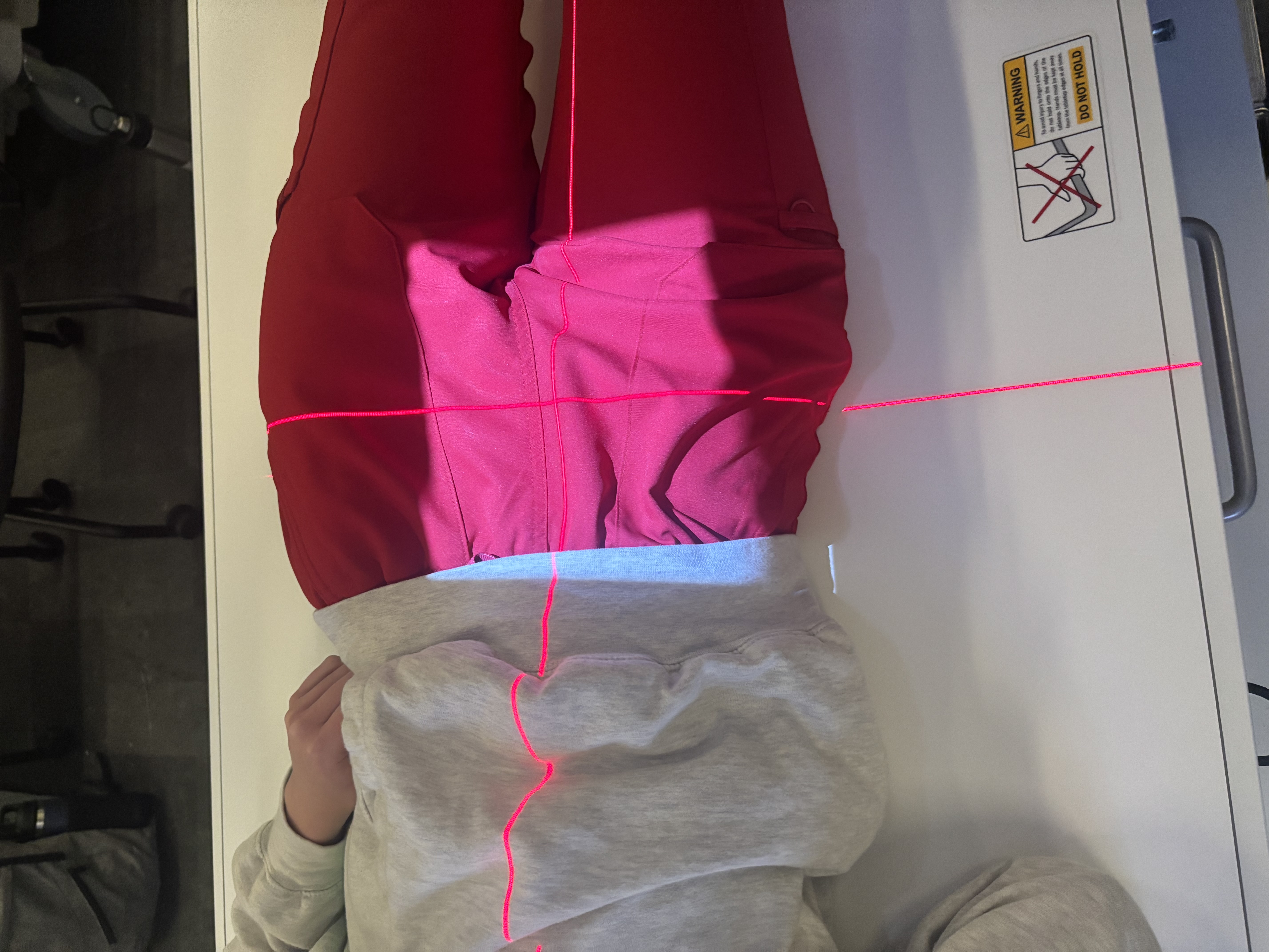 <p>Posterior Oblique Judet (Downside)</p>
