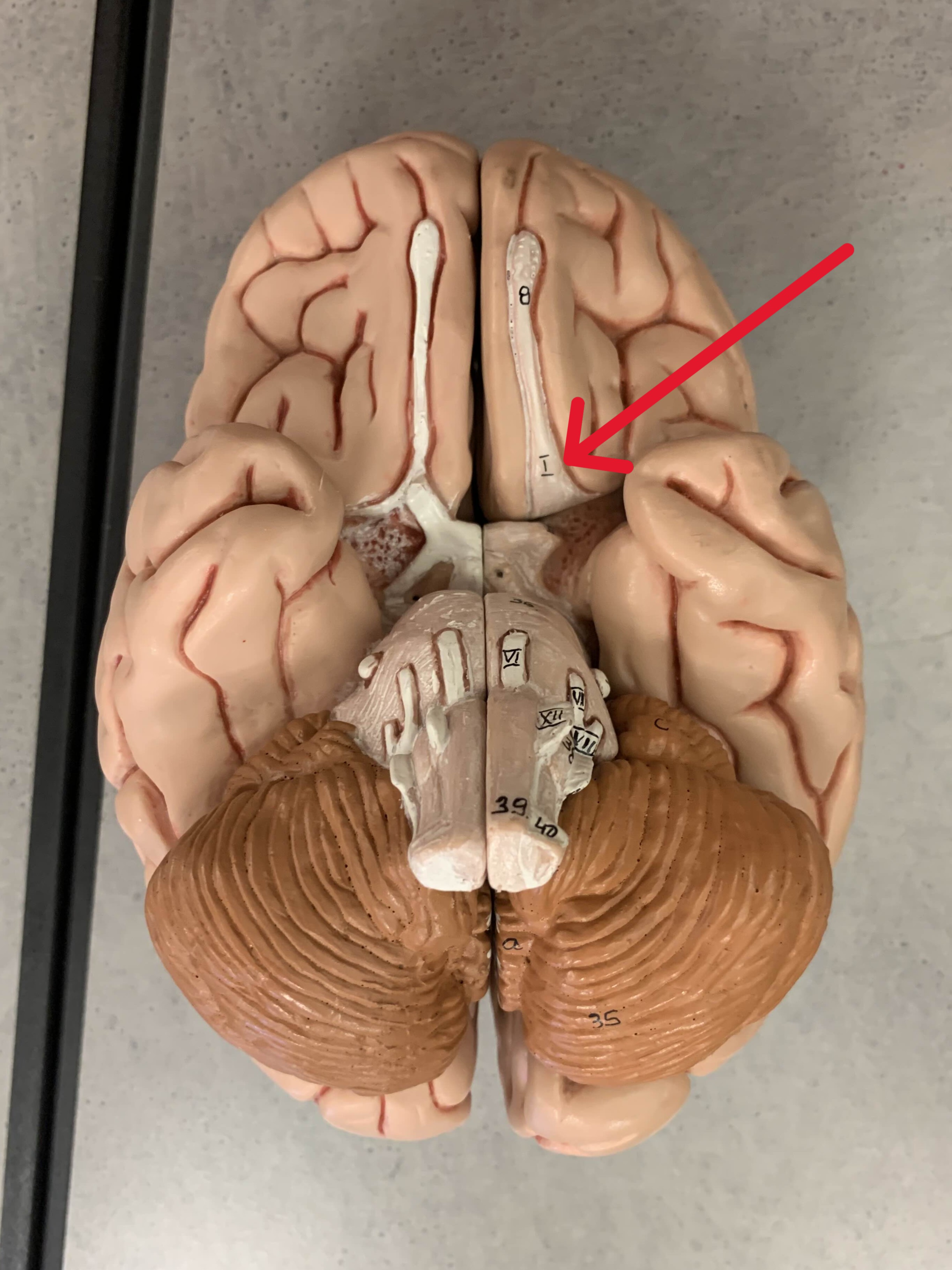 <p>Which nerve of the brain is:</p><ul><li><p>Roof of nasal cavity</p></li><li><p>Superior to optic</p></li></ul><p></p>