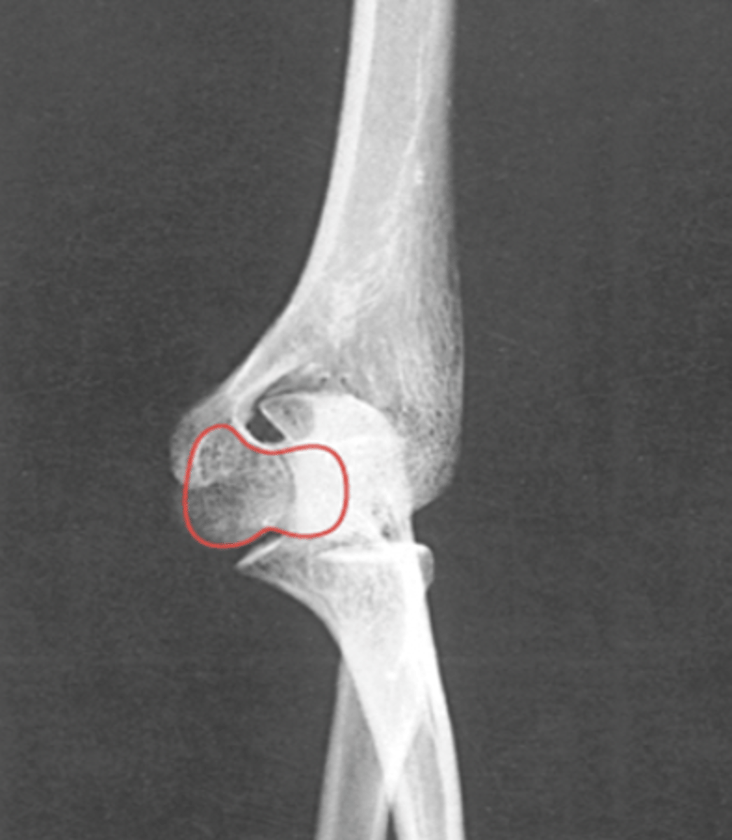 <p>What structure is highlighted?</p>