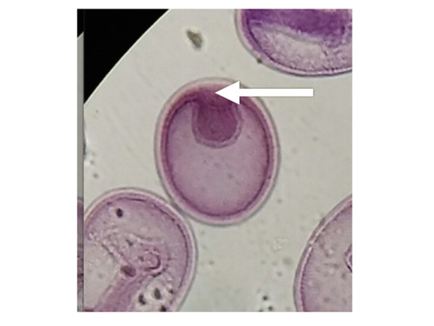 <p>the opening of the central cavity of an embryo in the early stage of development.</p>