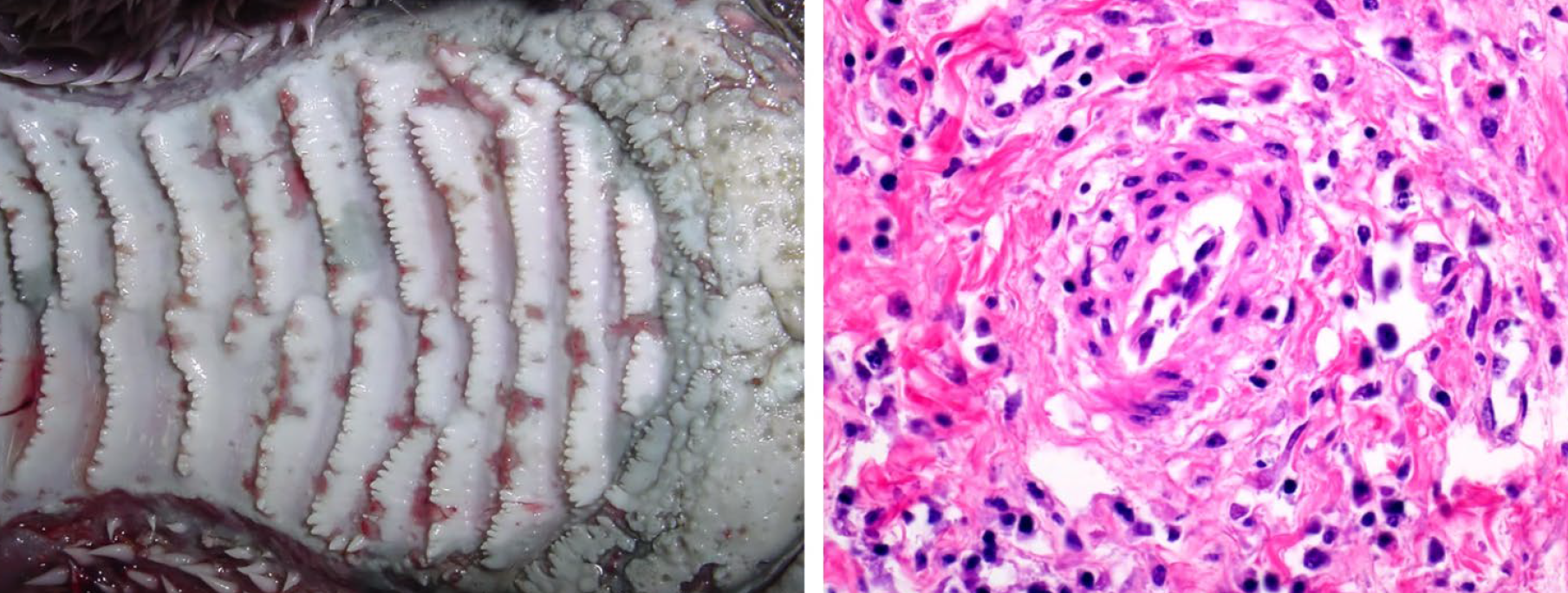 <p>What is the condition?</p><p>A-Foot and mouth disease </p><p>B-Bovine viral diarrhea</p><p>C-Papular stomatitis</p><p>D-lnfectious rhinotracheitis</p>