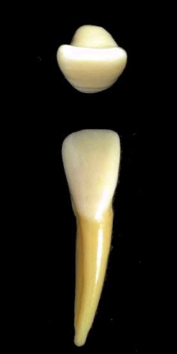 <p>what tooth is this &amp; why?</p>