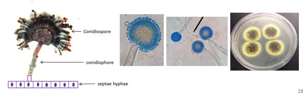 <ul><li><p>medically important black mold</p></li><li><p>black spores on top, yellow hyphae on bottom</p></li><li><p>names b/c it was thought to resemble an aspergillum which is a holy water sprinkler in the catholic church</p></li><li><p>most common mold (in wall sometimes)</p></li><li><p>causes lung infection - aspergillosis. Can cough up fungal balls which are not contagious</p></li><li><p>other species can be used to make soy sauce and soy paste</p></li></ul><p></p>