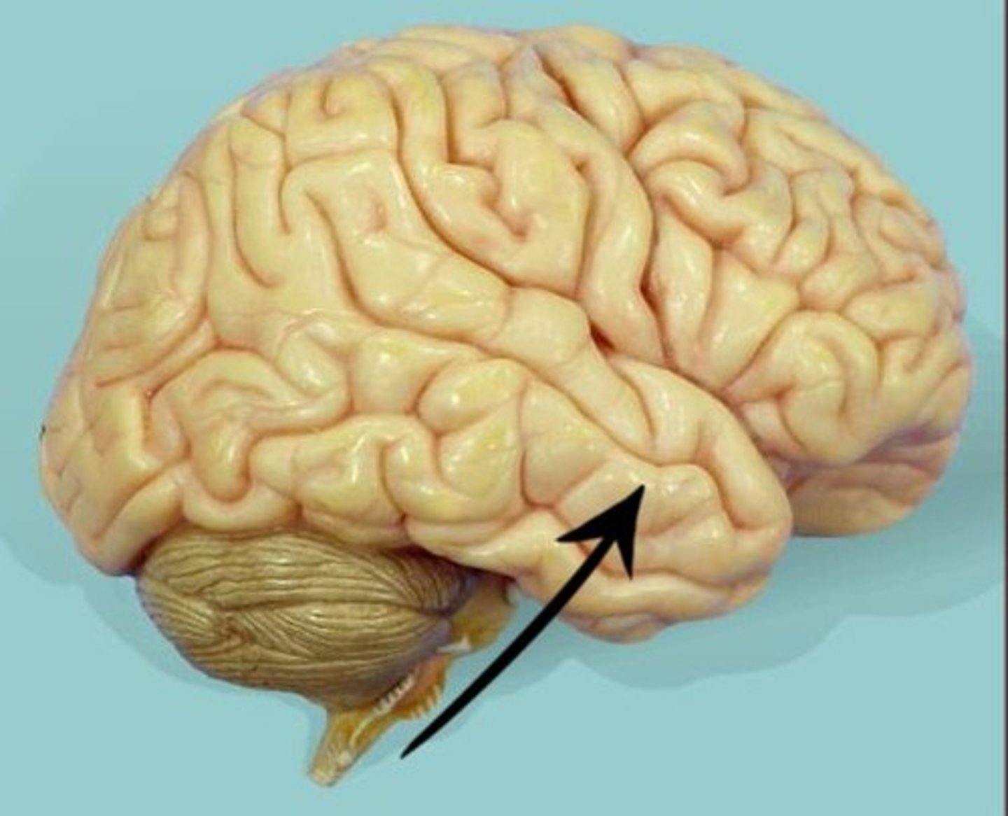 <p>Lobe at the lower sides of the cerebrum. Contains areas important to hearing and understanding speech.</p>