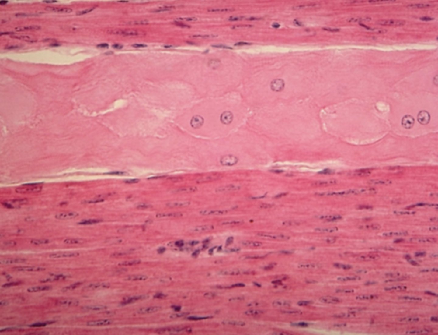 <p>Which is a feature of the tissue in the previous image of the heart (muscle tissue):</p><p>Tapered, non-striated cells with a central nucleusb. Branched, striated cells with a central nucleus</p><p>Branched, striated cells with a central nucleus</p><p>Long, striated cells with multiple peripheral nuclei</p>