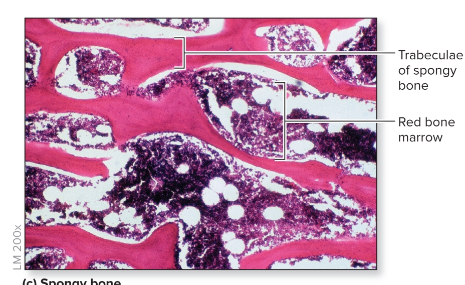<p>What is spongy bone?</p>