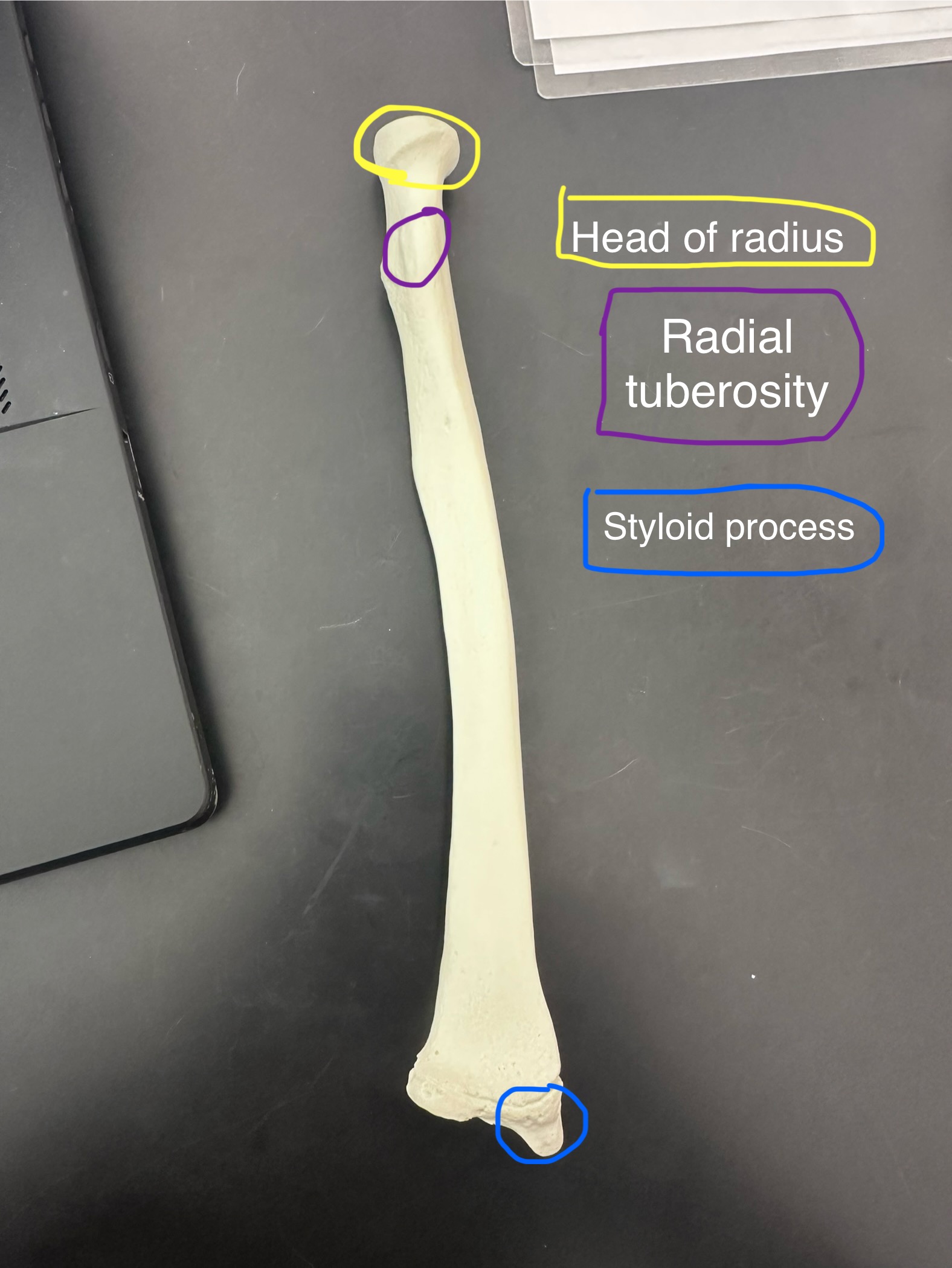 <p>Head of the radius</p>