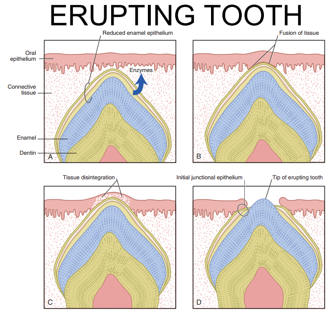 <p>F - it is the REE that fuses with the enamel epithelium. </p>