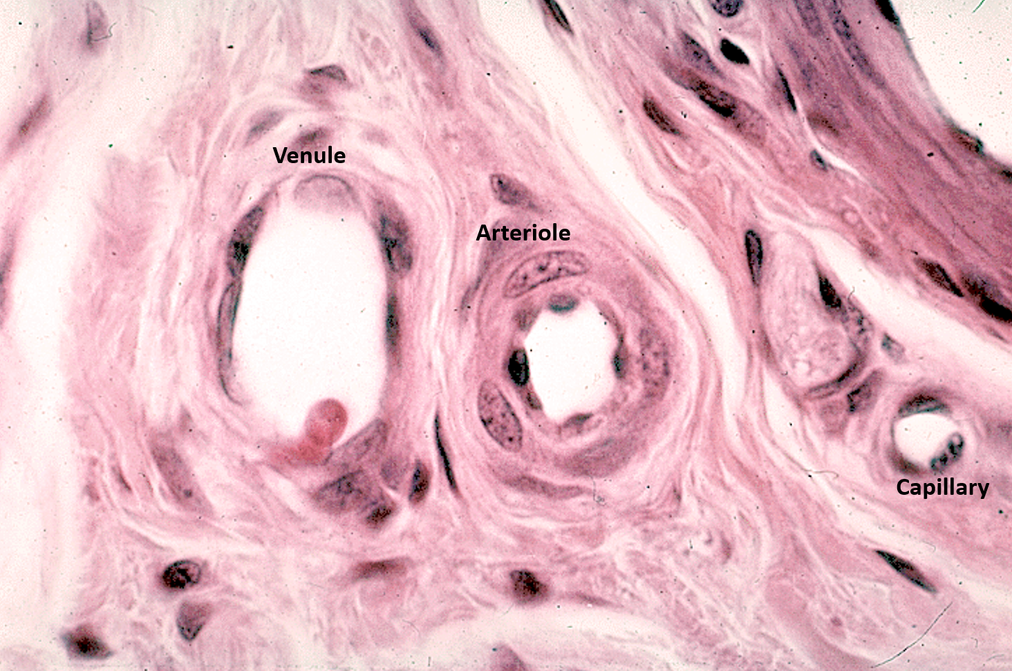 <ul><li><p><strong>Arteriole</strong> has <strong>one layer of smooth muscle</strong> surrounding it, giving it a <strong>small, circular lumen</strong></p></li><li><p><strong>Venules</strong> typically run <strong>adjacent to the arteriole</strong>, have a <strong>larger lumen</strong>, and lack a thick muscle layer</p></li><li><p><strong>Capillary</strong> is the <strong>smallest vessel</strong>; has <strong>endothelial nuclei</strong> and <strong>thin walls</strong> without smooth muscle</p></li></ul><p></p>