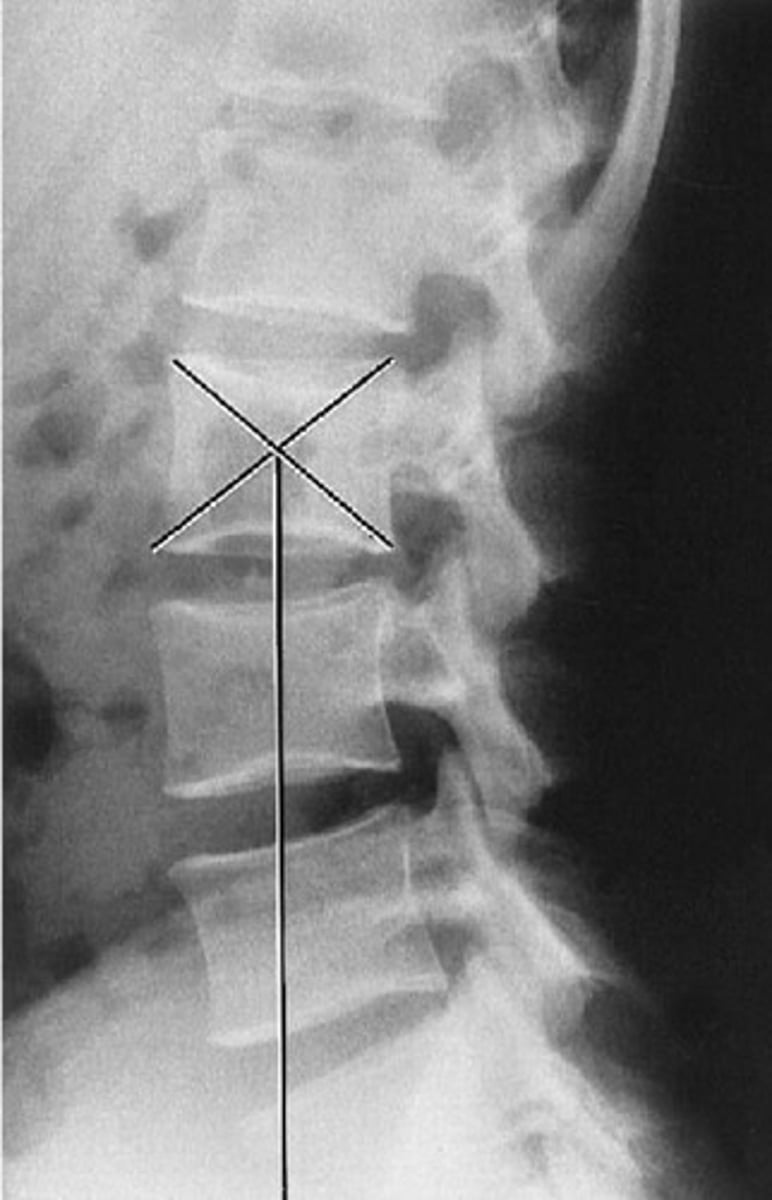 <p>What line of mensuration is this?</p>