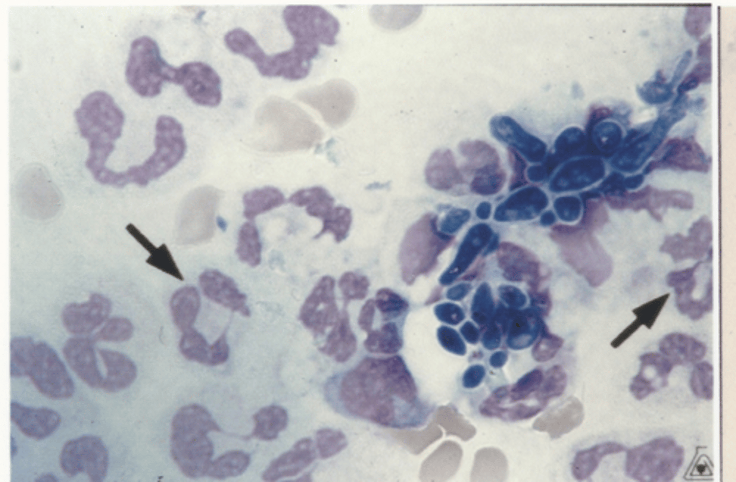 <p>Identify the cells in this body fluid</p>