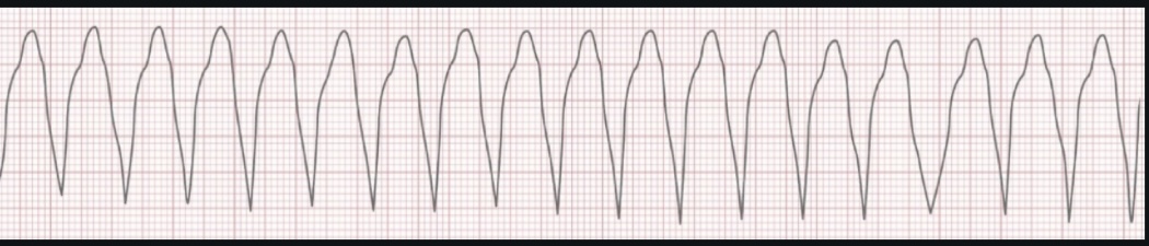 <p>ECG interpretation</p>
