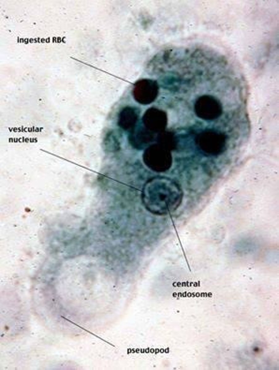 <p>Protozoa moving by pseudopodia, causing dysentery.</p>