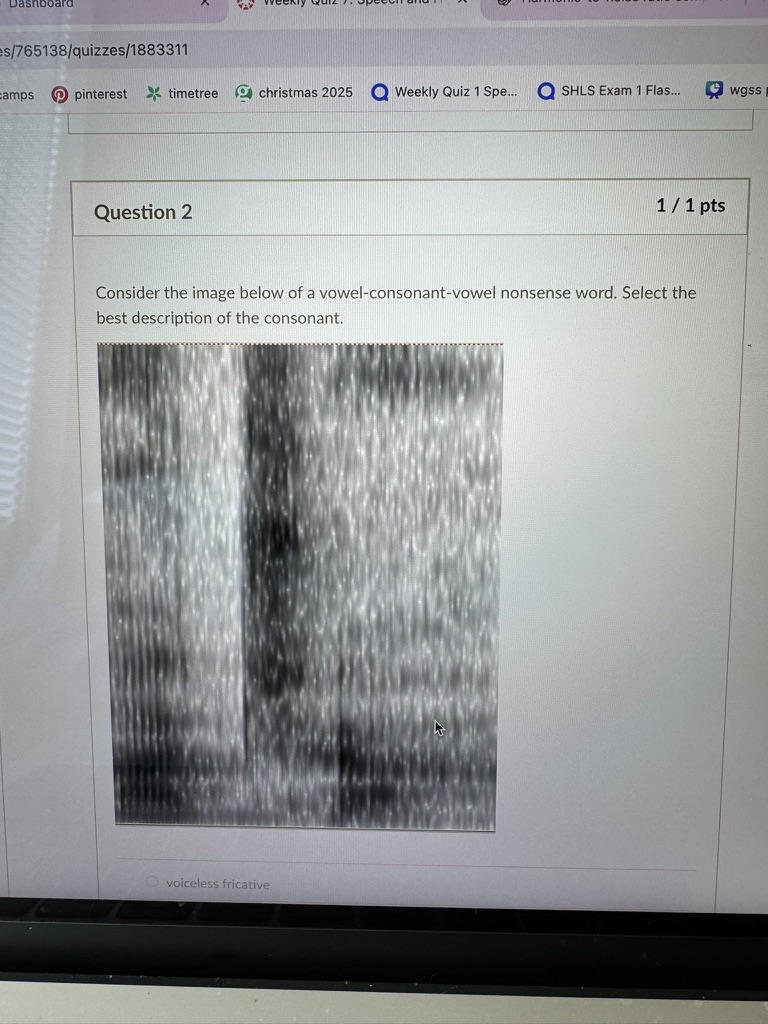<p>Consider the image below of a vowel-consonant-vowel nonsense word. Select the best description of the consonant.</p>