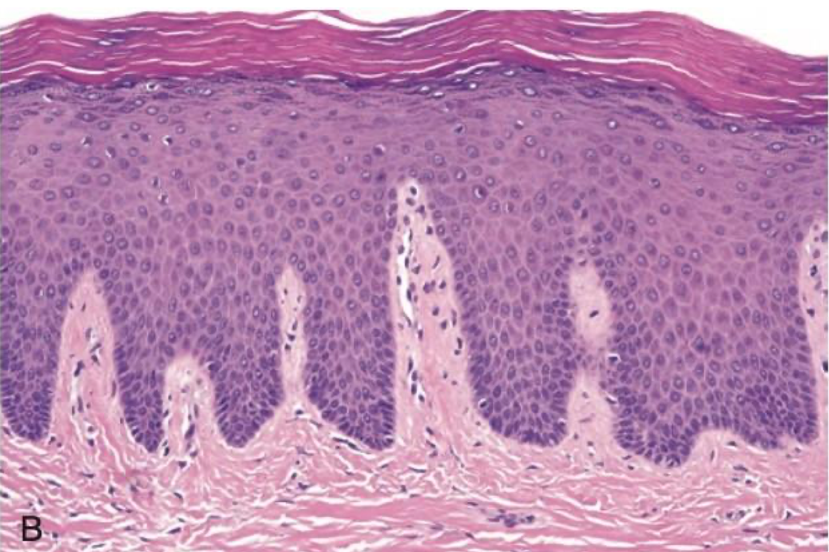 <p>which environmental/reactive lesion:</p>