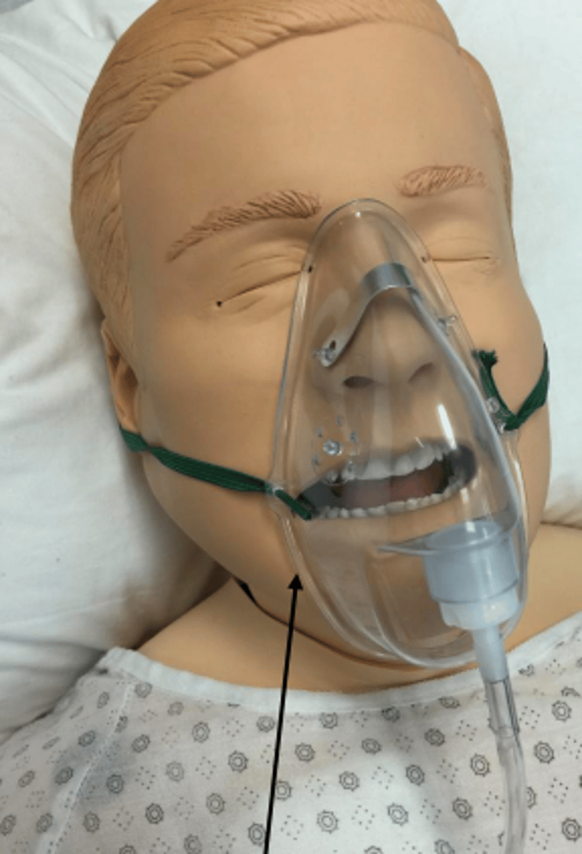 <p>Soft plastic mask that goes over the nose and mouth</p><p>- Used if pt.'s need more oxygen than nasal cannula can supply</p>