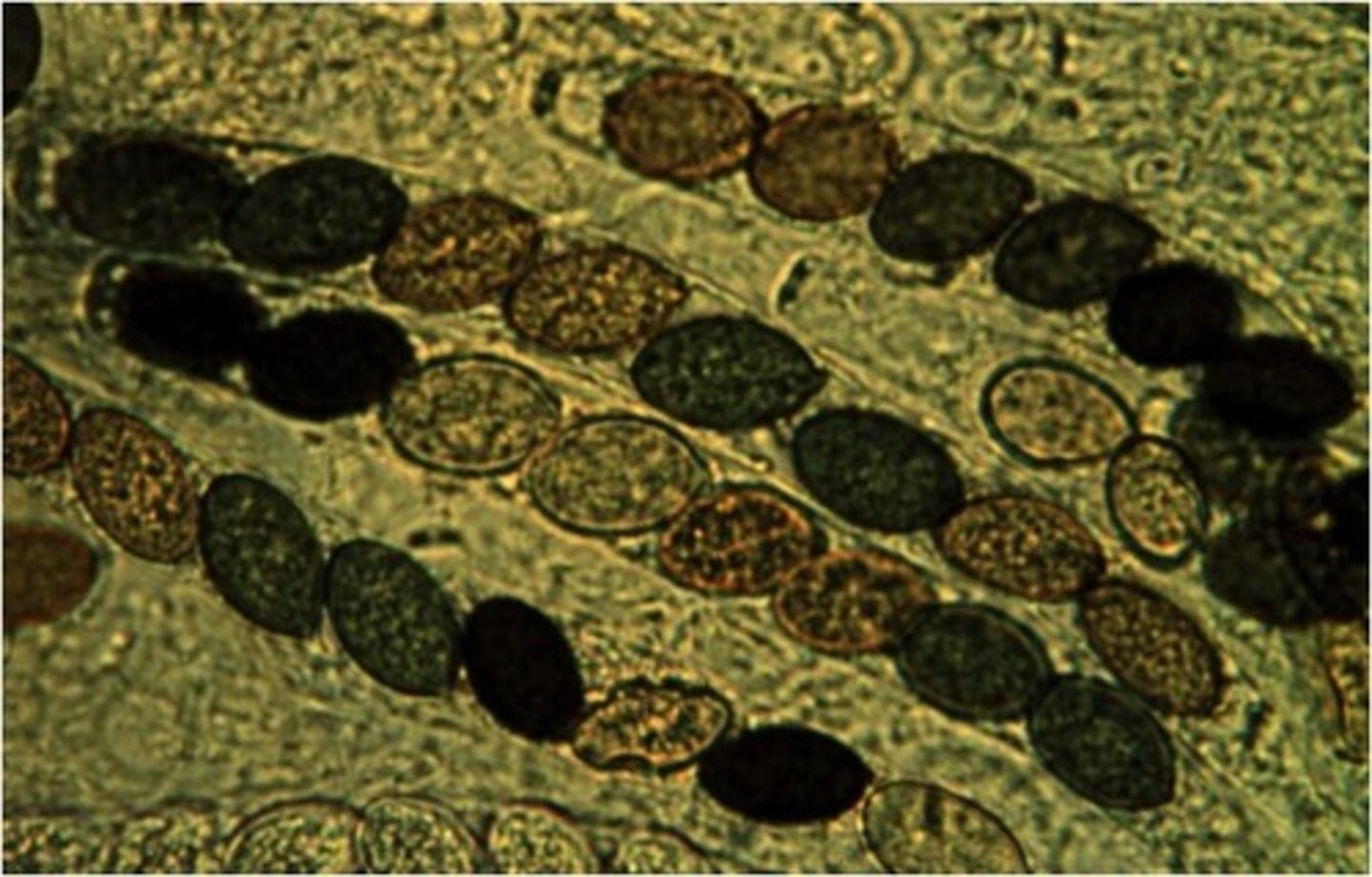 <p>ascomycete</p><p>round circle is ascospore</p>
