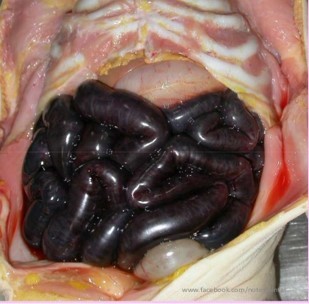 what type of gangrene is this?
