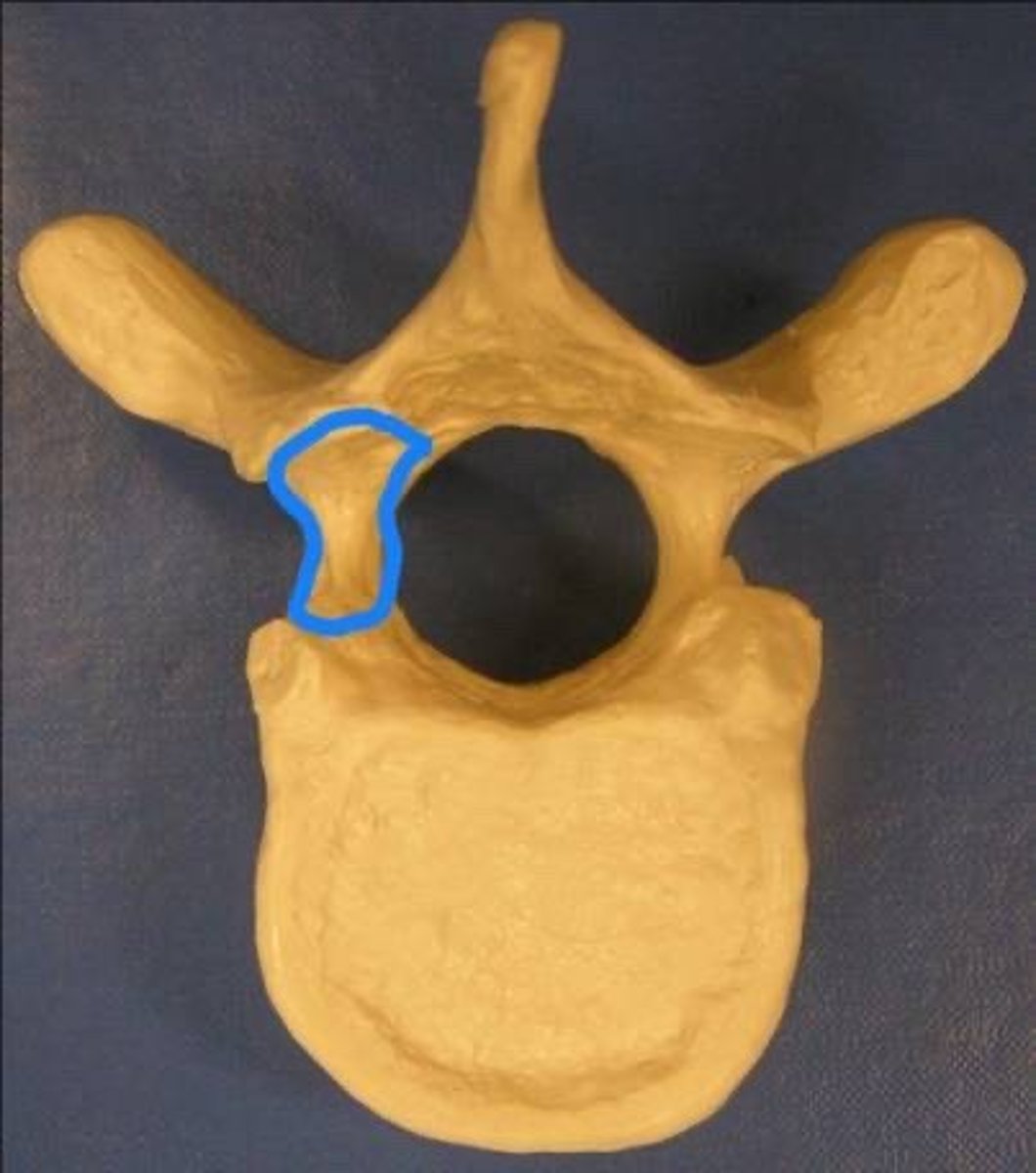 <p>portion of vertebral arch connected posteriorly to body</p>
