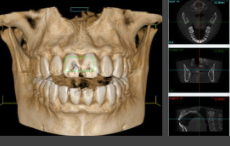 <p>A computer algorithm generates <strong>image volume</strong> (volumetric data set). They take images by secondary reconstruction into <strong>orthogonal</strong> <strong>planes</strong> (axial, sagittal, coronal)</p>