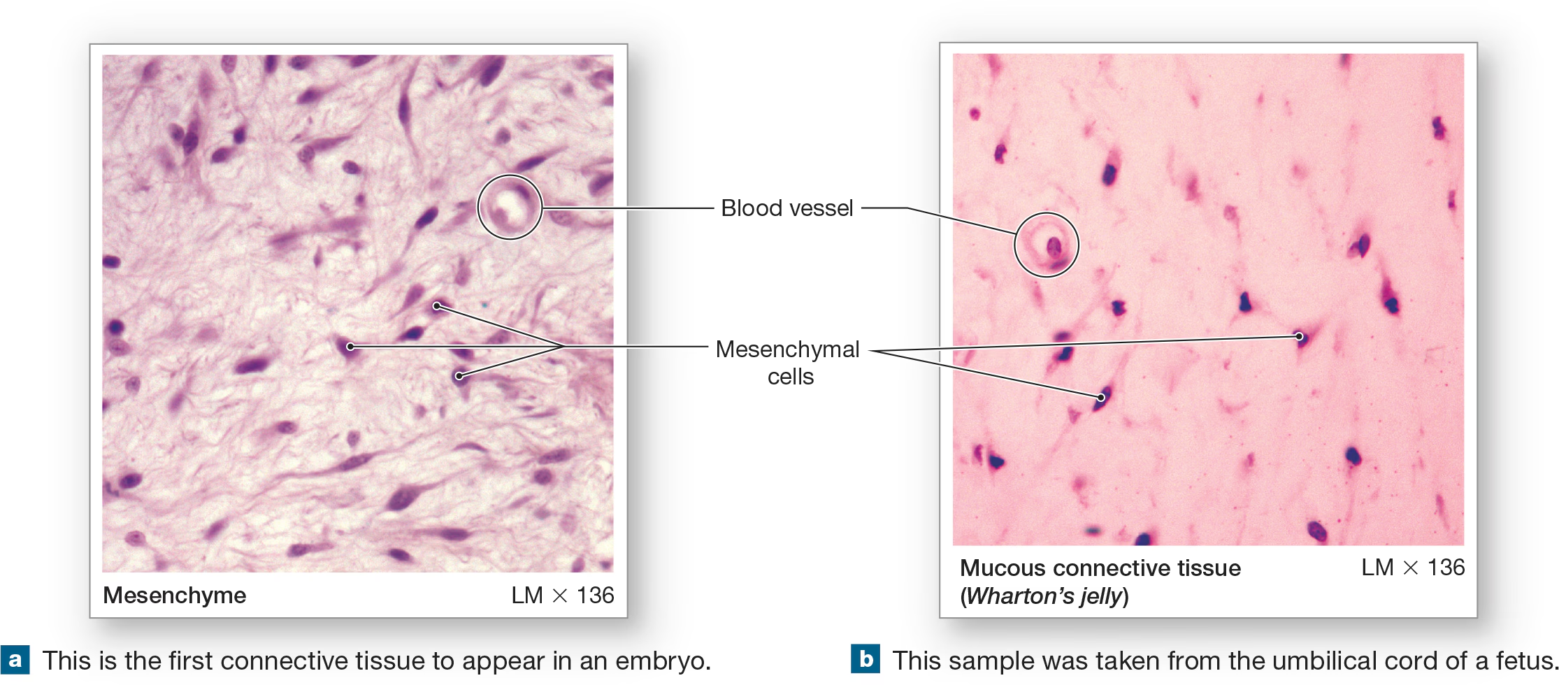 <p>embryonic tissue from which all connective tissues stem from</p>